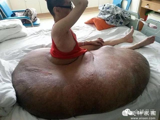 ���纱��������ά���������ϵ�ҽ�Σ�
